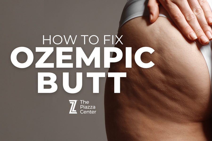 Close-up of a woman's hip and thigh showing cellulite and skin laxity, with "How to Fix Ozempic Butt" text overlay from The Piazza Center