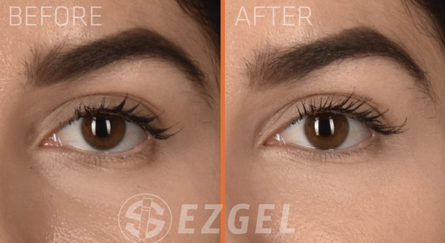 ezgel before and after