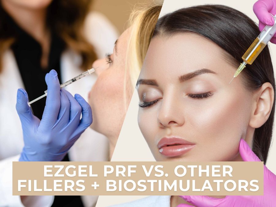 Split image comparing two women receiving facial filler injections, with EZGel PRF vs Other Fillers plus Biostimulators text overlay