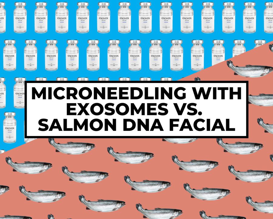 Mermaid Facial vs Exosomes microneedling