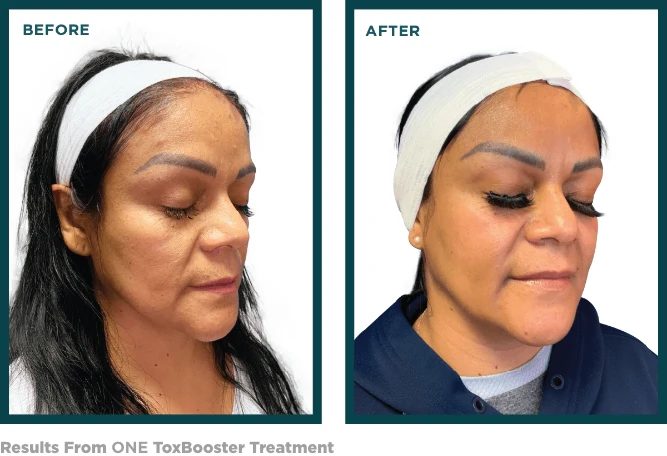 ToxBooster Results