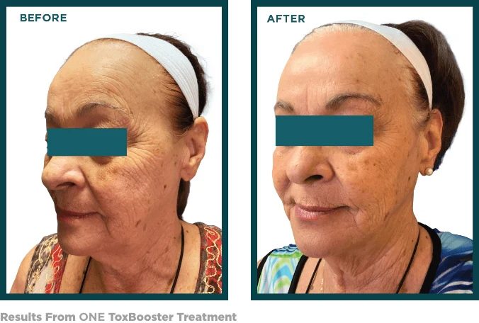 ToxBooster Treatment Results