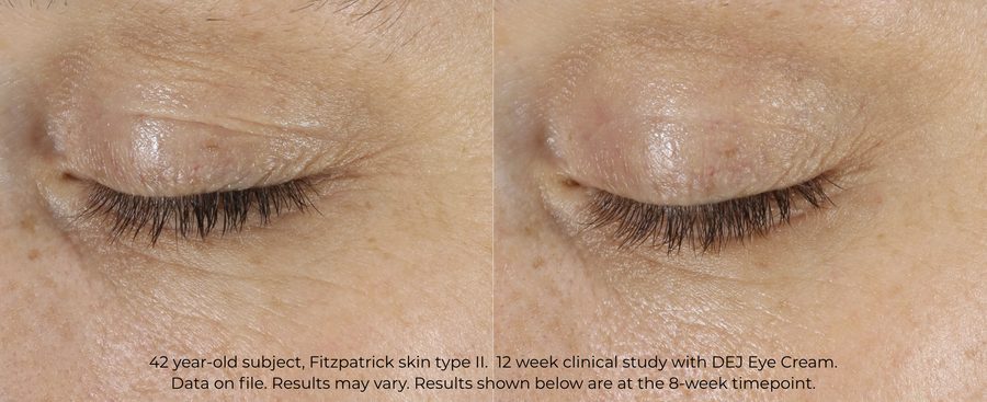 DEJ Eye Cream 